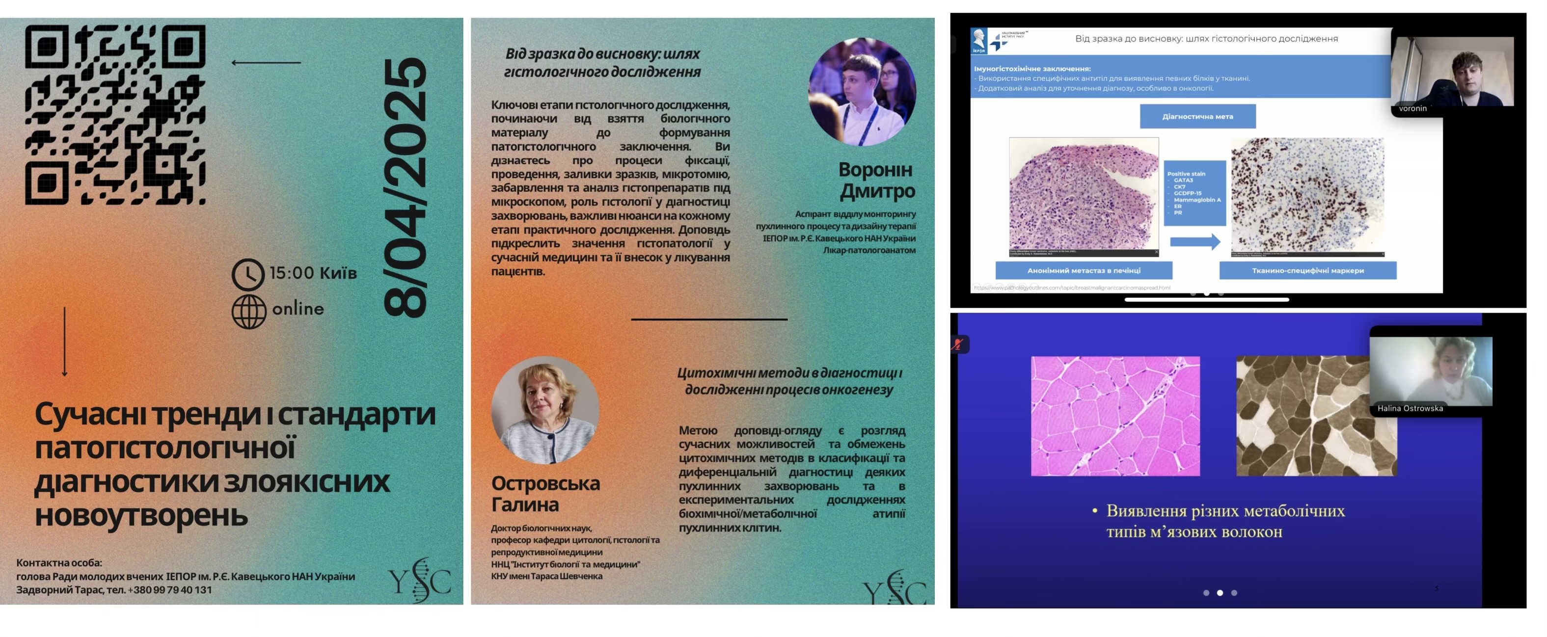 Участь співробітників кафедри у онлайн-семінарі «Сучасні тренди і стандарти патогістологічної діагностики злоякісних новоутворень» (08.04.2025 р.)